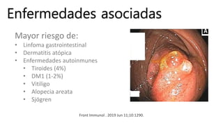 Enfermedades asociadas
Mayor riesgo de:
• Linfoma gastrointestinal
• Dermatitis atópica
• Enfermedades autoinmunes
• Tiroides (4%)
• DM1 (1-2%)
• Vitiligo
• Alopecia areata
• Sjögren
Front Immunol . 2019 Jun 11;10:1290.
 