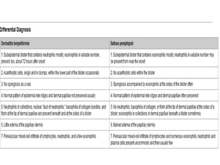 Dermatitis herpetiformis