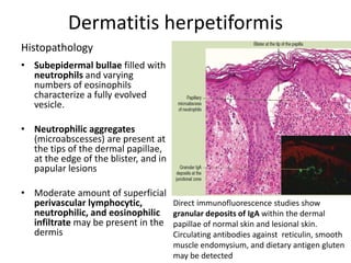 Histopathology
• Subepidermal bullae filled with
neutrophils and varying
numbers of eosinophils
characterize a fully evolved
vesicle.
• Neutrophilic aggregates
(microabscesses) are present at
the tips of the dermal papillae,
at the edge of the blister, and in
papular lesions
• Moderate amount of superficial
perivascular lymphocytic,
neutrophilic, and eosinophilic
infiltrate may be present in the
dermis
Dermatitis herpetiformis
Direct immunofluorescence studies show
granular deposits of IgA within the dermal
papillae of normal skin and lesional skin.
Circulating antibodies against reticulin, smooth
muscle endomysium, and dietary antigen gluten
may be detected
 