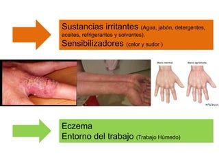 Sustancias irritantes (Agua, jabón, detergentes, 
aceites, refrigerantes y solventes). 
Sensibilizadores (calor y sudor ) 
Eczema 
Entorno del trabajo (Trabajo Húmedo) 
 
