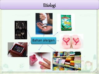 Etiologi
Bahan alergen
 