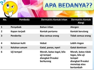 No. Pembeda Dermatitis Kontak Iritan Dermatitis Kontak
Alergi
1 Penyebab Bahan iritan Alergen
2 Kapan terjadi Kontak pertama Kontak berulang
3 Penderita Bisa semua orang Tidak semua orang
4 Kelainan kulit Hebat Lebih ringan
5 Keluhan umum Gatal, panas, nyeri Gatal dominan
6 Uji tempel Merah, batas tegal, bila
uji tempel
diangkatreaksi
berkurang
Merah, batas tidak
tegas, bila uji
tempel
diangkatreaksi
menetap atau
bertambah
 