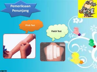 Pemeriksaan
Penunjang
Prick Test
Patch Test
 