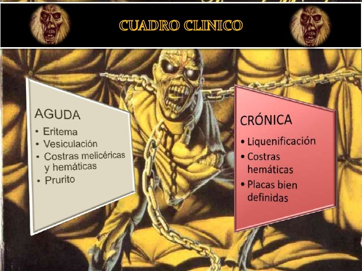 Dermatitis Por Contacto