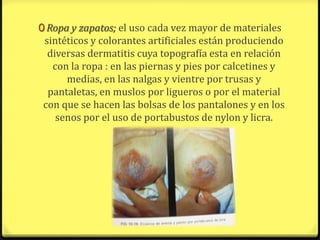 0 Ropa y zapatos; el uso cada vez mayor de materiales
 sintéticos y colorantes artificiales están produciendo
  diversas dermatitis cuya topografía esta en relación
   con la ropa : en las piernas y pies por calcetines y
      medias, en las nalgas y vientre por trusas y
  pantaletas, en muslos por ligueros o por el material
 con que se hacen las bolsas de los pantalones y en los
    senos por el uso de portabustos de nylon y licra.
 