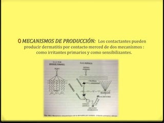 0 MECANISMOS DE PRODUCCIÓN: Los contactantes pueden
  producir dermatitis por contacto merced de dos mecanismos :
       como irritantes primarios y como sensibilizantes.
 