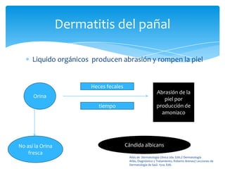 Dermatitis del pañal

      Liquido orgánicos producen abrasión y rompen la piel


                        Heces fecales
                                                             Abrasión de la
      Orina
                                                                piel por
                           tiempo                            producción de
                                                               amoniaco




No así la Orina                         Cándida albicans
    fresca
                                         Atlas de Dermatología Clínica 2da. Edit.// Dermatología
                                         Atlás, Diagnóstico y Tratamiento, Roberto Arenas// Lecciones de
                                         Dermatología de Saúl. 15va. Edit.
 