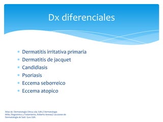 Dx diferenciales


                 Dermatitis irritativa primaria
                 Dermatitis de jacquet
                 Candidiasis
                 Psoriasis
                 Eccema seborreico
                 Eccema atopico


Atlas de Dermatología Clínica 2da. Edit.// Dermatología
Atlás, Diagnóstico y Tratamiento, Roberto Arenas// Lecciones de
Dermatología de Saúl. 15va. Edit.
 
