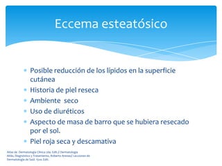 Eccema esteatósico


                 Posible reducción de los lípidos en la superficie
                 cutánea
                 Historia de piel reseca
                 Ambiente seco
                 Uso de diuréticos
                 Aspecto de masa de barro que se hubiera resecado
                 por el sol.
                 Piel roja seca y descamativa
Atlas de Dermatología Clínica 2da. Edit.// Dermatología
Atlás, Diagnóstico y Tratamiento, Roberto Arenas// Lecciones de
Dermatología de Saúl. 15va. Edit.
 