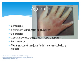 Agentes:


                 Cementos
                 Resinas en la industria de plásticos
                 Colorantes
                 Gomas : por uso de guantes, ropa o zapatos.
                 Pegamentos
                 Metales: común en joyería de mujeres (cobalto y
                 níquel)

Atlas de Dermatología Clínica 2da. Edit.// Dermatología
Atlás, Diagnóstico y Tratamiento, Roberto Arenas// Lecciones de
Dermatología de Saúl. 15va. Edit.
 