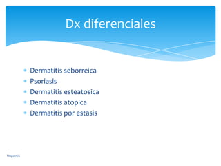 Dx diferenciales


              Dermatitis seborreica
              Psoriasis
              Dermatitis esteatosica
              Dermatitis atopica
              Dermatitis por estasis




fitzpatrick
 