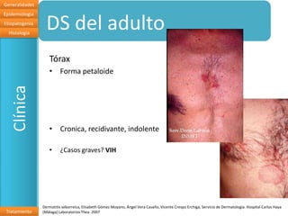 Generalidades
Epidemiologia
Etiopatogenia
  Histología
                  DS del adulto
                   Tórax
                   • Forma petaloide
   Clínica




                   • Cronica, recidivante, indolente

                   •      ¿Casos graves? VIH




                Dermatitis seborreica, Elisabeth Gómez Moyano, Ángel Vera Casaño, Vicente Crespo Erchiga, Servicio de Dermatología. Hospital Carlos Haya
 Tratamiento    (Málaga) Laboratorios Thea. 2007
 