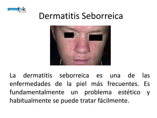 Dermatitis Seborreica
La dermatitis seborreica es una de las
enfermedades de la piel más frecuentes. Es
fundamentalmente un problema estético y
habitualmente se puede tratar fácilmente.
 