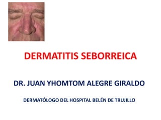 DERMATITIS SEBORREICA
DR. JUAN YHOMTOM ALEGRE GIRALDO
DERMATÓLOGO DEL HOSPITAL BELÉN DE TRUJILLO
 