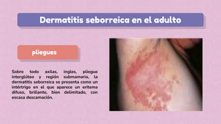 Sobre todo axilas, ingles, pliegue
interglúteo y región submamaria, la
dermatitis seborreica se presenta como un
intértrigo en el que aparece un eritema
difuso, brillante, bien delimitado, con
escasa descamación.
Dermatitis seborreica en el adulto
pliegues
 