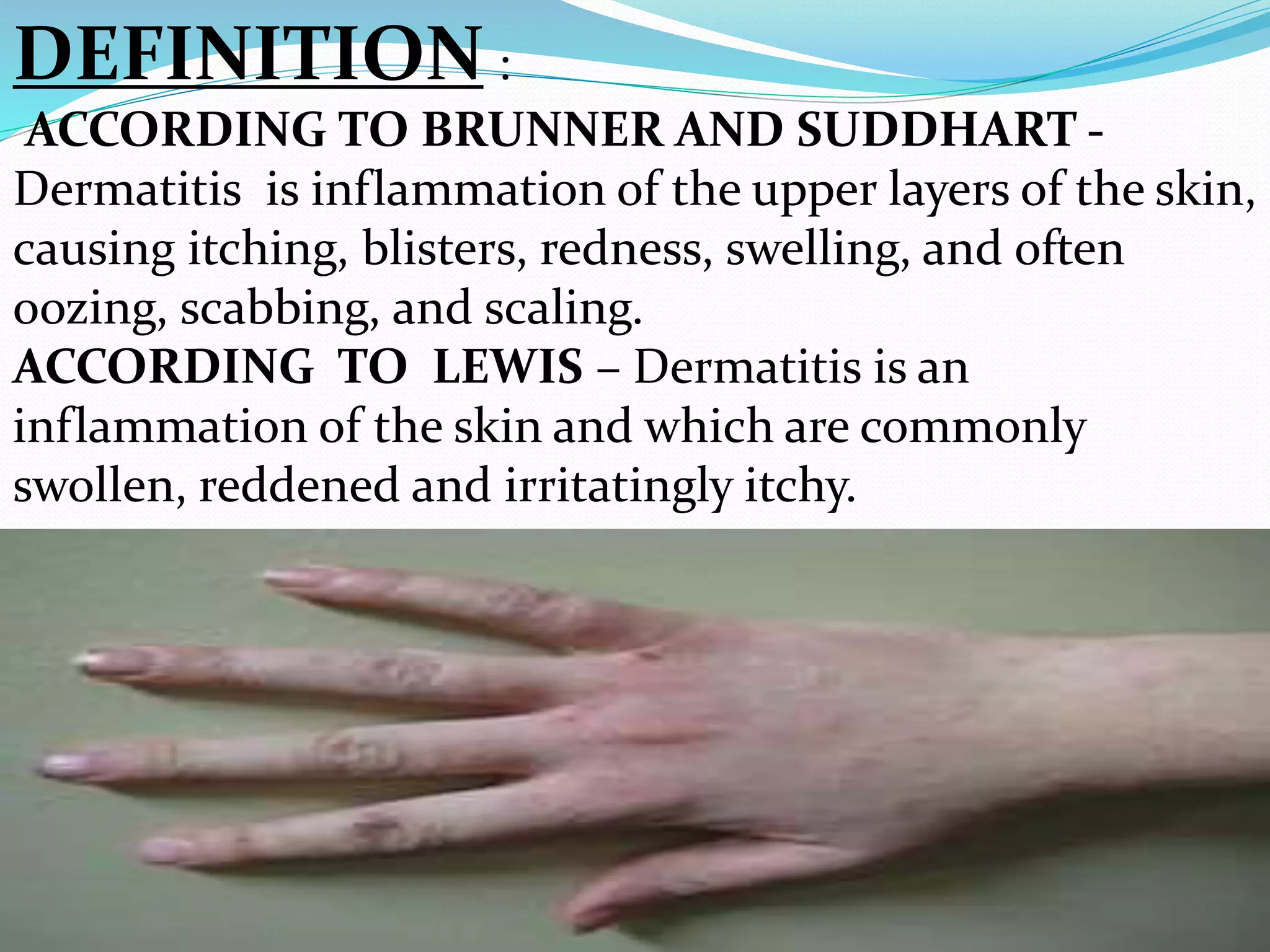 Dermatitis slide | PDF