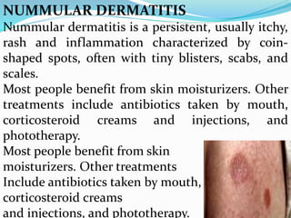 Coin Rash Dermatitis slide | PDF