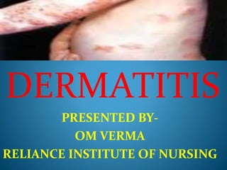 DERMATITIS
PRESENTED BY-
OM VERMA
RELIANCE INSTITUTE OF NURSING
 