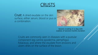 CRUSTS
Crust: A dried exudate on the skin
surface, either serum, blood or pus or
a combination.
Severe crusting in a dog with
scabies of several months duration
Crusts are commonly seen in diseases with a pustular
component (eg canine pyoderma, pemphigus
foliaceus), and where the exudate from erosions and
ulcers dries on the surface of the lesion.
 
