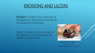 EROSIONS AND ULCERS
Erosion: A break in the continuity of
the epidermis that does not penetrate
the basement membrane.
Ulcer: A break in the continuity of
the epidermis that penetrates the
basement membrane.
Footpad ulceration in a
retriever with
epitheliotropic lymphoma
 