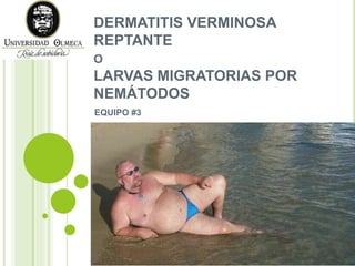 DERMATITIS VERMINOSA
REPTANTE
O
LARVAS MIGRATORIAS POR
NEMÁTODOS
EQUIPO #3
 