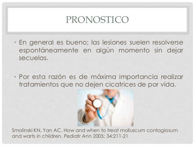 La psoriasis nuevo el tratamiento