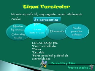 Dermatitis y Tiñas Practica Medica I Micosis superficial, cuyo agente causal:  Malassezia Furfur. LOCALIZADA EN:  Cuero cabelludo Tórax Espalda Parte proximal y distal de extremidades Se caracteriza por 
