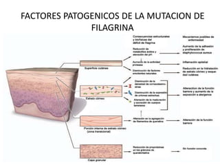 FACTORES PATOGENICOS DE LA MUTACION DE
FILAGRINA
 
