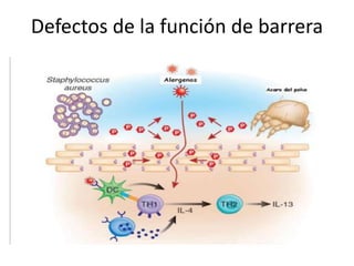 Defectos de la función de barrera
 