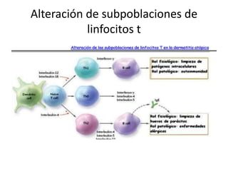 Alteración de subpoblaciones de
linfocitos t
 
