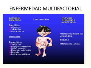 ENFERMEDAD MULTIFACTORIAL
 
