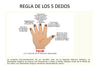 REGLA DE LOS 5 DEDOS
 