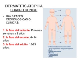 DERMATITIS ATOPICA
CUADRO CLINICO
• HAY 3 FASES
CRONOLOGICAS O
CLINICAS:
1. la fase del lactante. Primeras
semanas y 2 años.
2. la fase del escolar. 4- 14
años
3. la fase del adulto. 15-23
años.
 