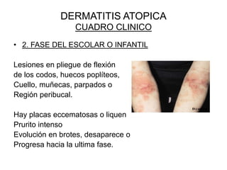 DERMATITIS ATOPICA
CUADRO CLINICO
• 2. FASE DEL ESCOLAR O INFANTIL
Lesiones en pliegue de flexión
de los codos, huecos poplíteos,
Cuello, muñecas, parpados o
Región peribucal.
Hay placas eccematosas o liquenificadas.
Prurito intenso
Evolución en brotes, desaparece o
Progresa hacia la ultima fase.
 