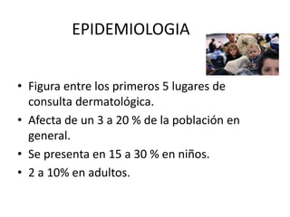 EPIDEMIOLOGIA
• Figura entre los primeros 5 lugares de
consulta dermatológica.
• Afecta de un 3 a 20 % de la población en
general.
• Se presenta en 15 a 30 % en niños.
• 2 a 10% en adultos.
 