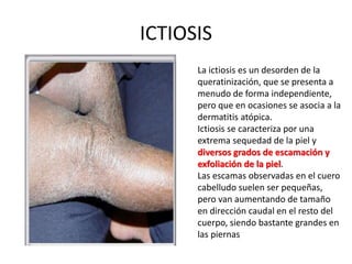 ICTIOSIS
La ictiosis es un desorden de la
queratinización, que se presenta a
menudo de forma independiente,
pero que en ocasiones se asocia a la
dermatitis atópica.
Ictiosis se caracteriza por una
extrema sequedad de la piel y
diversos grados de escamación y
exfoliación de la piel.
Las escamas observadas en el cuero
cabelludo suelen ser pequeñas,
pero van aumentando de tamaño
en dirección caudal en el resto del
cuerpo, siendo bastante grandes en
las piernas
 