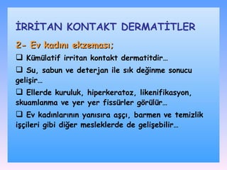 2 -  Ev kadını ekzeması ;   K ümülatif irritan kontakt dermatit dir… S u, sabun ve deterjan ile sık değinme sonucu geliş ir… Ellerde kuruluk, hiperkeratoz, likenifikasyon, skuamlanma ve yer yer fissürler  görülür… E v kadınların ın yanısıra  aşçı, barmen ve temizlik işçileri gibi diğer mesleklerde de gelişebilir … İRRİTAN KONTAKT DѴİLER 