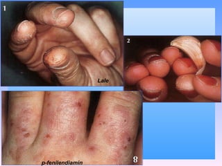 p-fenilendiamin  Lale 
