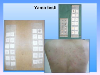 Yama testi 