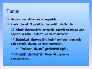 H emen her döneminde kaşıntılı … K linik olarak  3 şekilde  dermatit görü lebilir; Akut  dermatit ;  eritemli - ödemli zeminde çok sayıda vezikül ,  sulantı ve krutlanmalar … Subakut  dermatit ;   hafif eritemli zeminde çok sayıda skuam ve krutlanmalar …   “ Y akacık skuam&quot;  görünümü tipik… K ronik  dermatit ; l ikenifikasyon ve skuamlanma … Tanım 