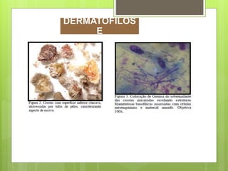 DERMATOFILOS
E
 