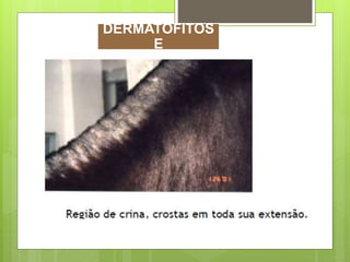 DERMATOFITOS
E
 