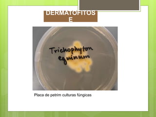Placa de petrim culturas fúngicas
DERMATOFITOS
E
 