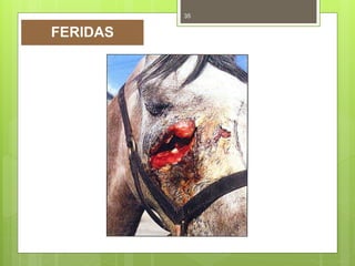 35
FERIDAS
 