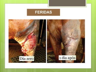 FERIDAS
 