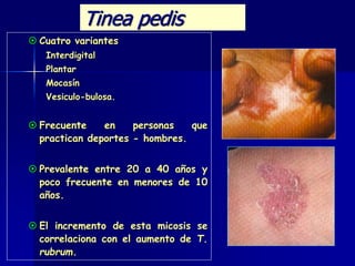  Cuatro variantes
Interdigital
Plantar
Mocasín
Vesiculo-bulosa.
 Frecuente en personas que
practican deportes - hombres.
 Prevalente entre 20 a 40 años y
poco frecuente en menores de 10
años.
 El incremento de esta micosis se
correlaciona con el aumento de T.
rubrum.
Tinea pedis
 