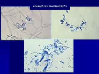 Trichophyton mentagrophytes
 