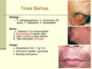 Etiologi :
 T. mentagrophytes, T. verucosum, M.
canis, T. violaceum, T. schoenleini
Klinis :
⇒ Dikenal 3 tipe tinea barbae
1. Peradangan ≈ kerion celci
2. Tipe superfisial atau sikosis
3. Tipe menyebar sirsinata
Tinea Barbae
Terapi:
• Griseofulvin 0,5 - 1 gr / hr.
• Anti jamur topikal : gol azole
• Shampo anti jamur
 