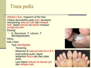 Tinea pedis
 Athlete’s foot, ringworm of the foot
 Infeksi dermatofita pada kaki, terutama
menyerang sela jari kaki dan telapak
kaki, dapat meluas ke lateral maupun
punggung kaki
 Etiologi
 E. floccosum, T. rubrum, T.
Mentagrophytes
 Klinis:
Ada 3 tipe:
1. Tipe interdigitalis
– Tersering
– Maserasi di sela jari kaki ke-4 & 5
– Kulit terlihat putih, dapat
terbentuk fisura dan bau tidak
enak
– Lesi dapat meluas ke bawah jari
dan telapak kaki
 