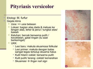Pityriasis versicolor
 Etiologi: M. furfur
 Gejala klinis
 Usia: >> usia belasan
 Lokasi: bagian atas dada & meluas ke
lengan atas, leher & perut / tungkai atas/
bawah
 Keluhan: bercak berwarna putih /
kecoklatan, gatal ringan (tu saat
berkeringat)
 UKK:
 Lesi baru: makula skuamosa folikular
 Lesi primer: makula dengan batas
sangat tegas tertutup skuama halus
 Kulit hitam/ coklat: berwarna putih
 Kulit putih/ terang: coklat/ kemerahan
 Skuamasi  finger nail sign
 